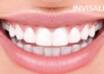 Invisalign specialist in Bahrain