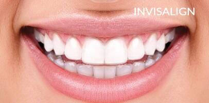 Invisalign specialist in Bahrain