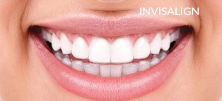 Invisalign specialist in Bahrain